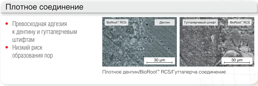 bioroot rcs