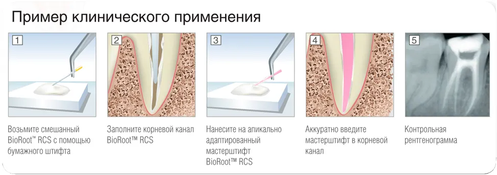 био роот септодонт