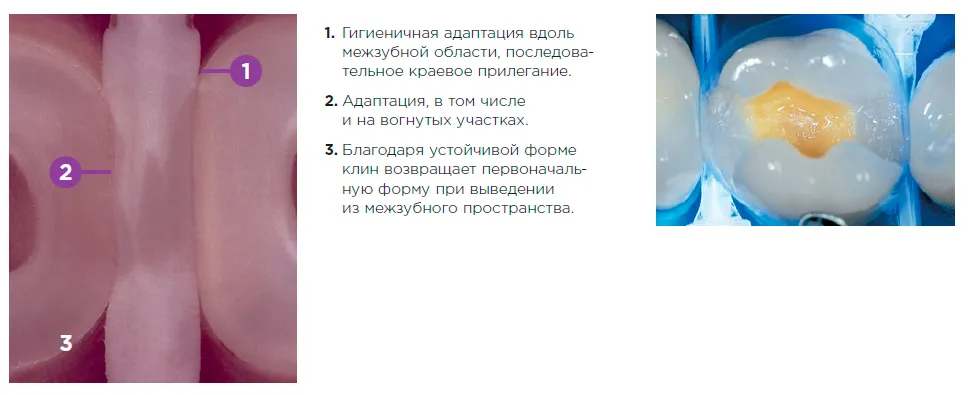 Клинья Luciwedges