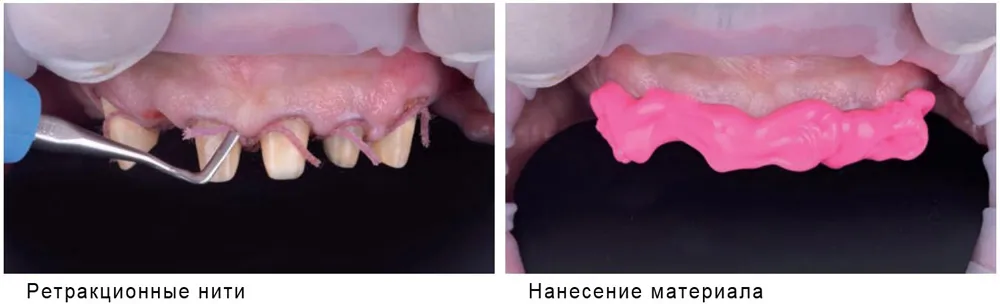 Hydrorise Hydrorise