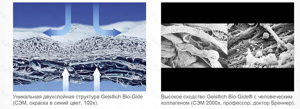 Geistlich Bio-Gide является ведущей коллагеновой мембраной для регенерации тканей полости рта Geistlich Bio-Gide является ведущей коллагеновой мембраной для регенерации тканей полости рта