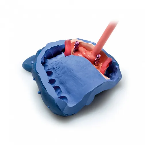 Десневая маска Гингифаст ригид (Gingifast-RIGID), 2x50мл+10мл, С401520, Zhermack