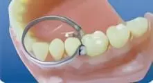 Установка с кольцом - этап 3