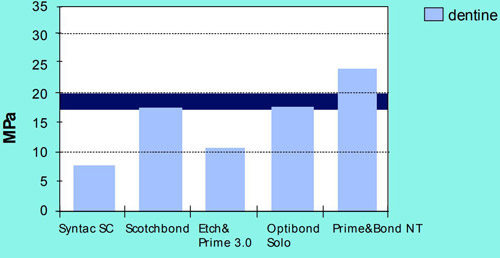 Prime&Bond NT Dentsply