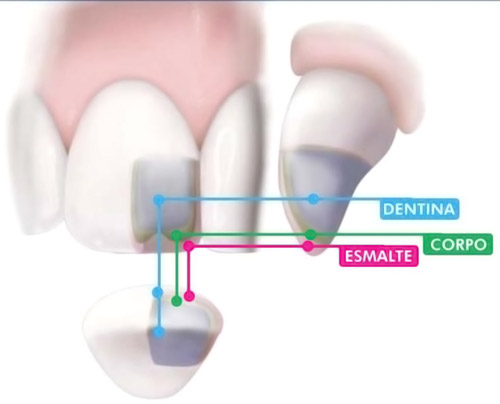 Esthet-X Dentsply