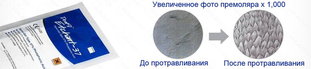 DenFil Etchant протравочный гель 37% фосфорной кислоты DenFil Etchant протравочный гель 37% фосфорной кислоты