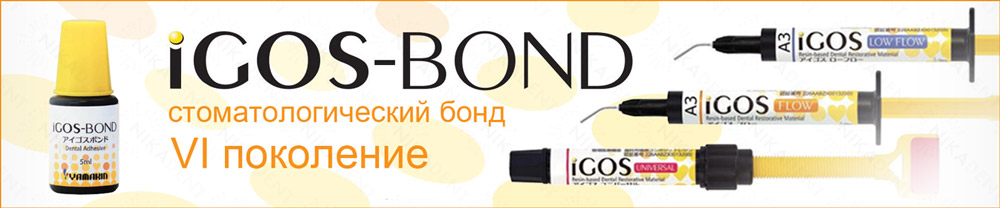 iGOS BOND - стоматологический адгезив 6 поколения