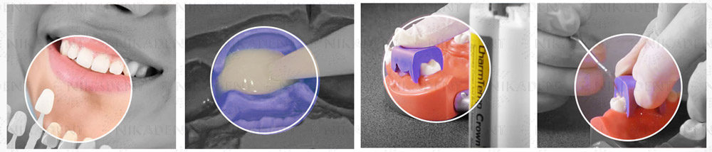 CharmTemp Crown - композит для изготовления временных коронок