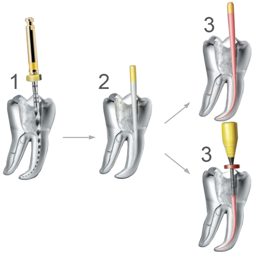 Обтураторы Thermafil Dentsply