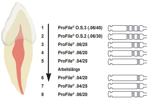 Профайлы Dentsply использование