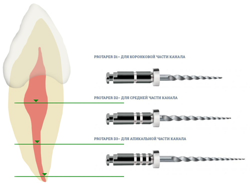 Машинные протейперы Protaper Universal Dentsply