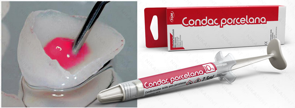 Condac porcelana гель плавиковой кислоты 10% для травления изделий из стоматологической керамики.