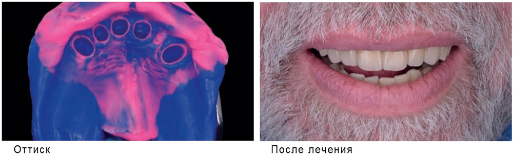 Hydrorise Hydrorise