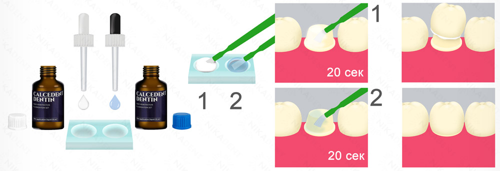 Дентин герметизирующий ликвид, глубокий фторид. Инструкция.