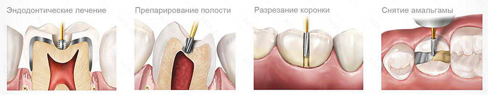 Твердосплавные буры для разрезания коронок