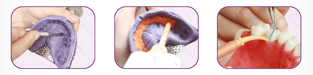 А-силикон, стоматологическая слепочная масса на основе А-силикона.