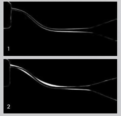 ProGlider Dentsply