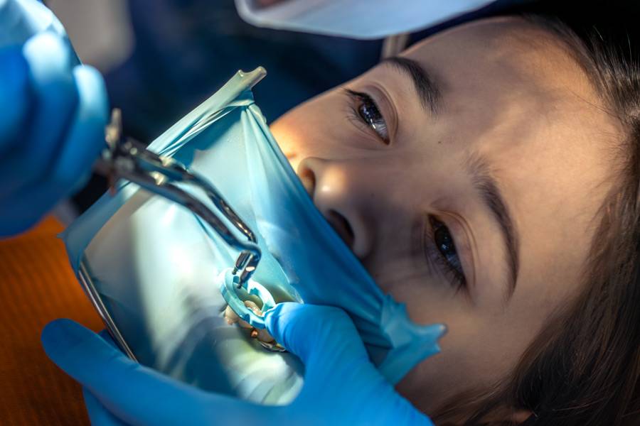 dentist-treats-childs-tooth-using-rubber-dam-closeup-tooth-treatment.jpg dentist-treats-childs-tooth-using-rubber-dam-closeup-tooth-treatment.jpg