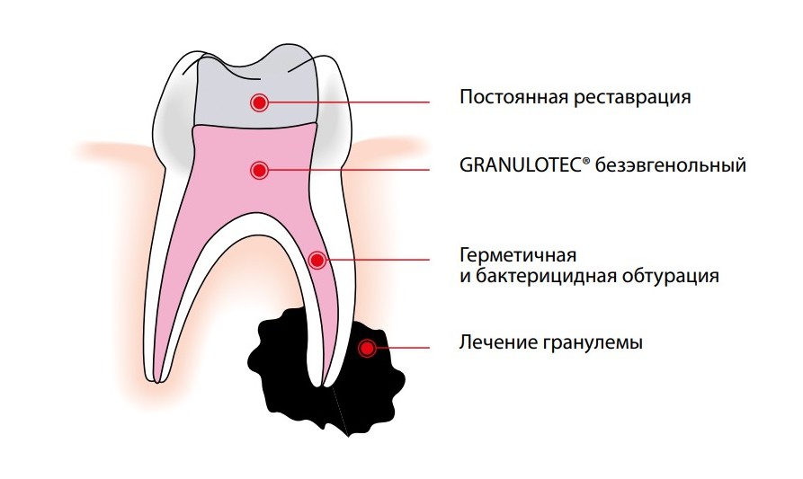 гран.jpg