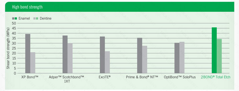 Gluma 2Bonв - адгезивная система однокомпонентная, тотального протравливания (5 поколение). Сделано в Германии.