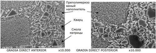 GRADIA DIRECT ANTERIOR и POSTERIOR 