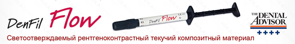 Denfil Flow текучий композитный материал