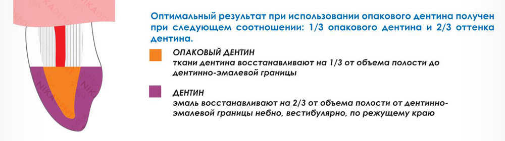 Дентлайт, композитный реставрационный материал, пакуемый, светоотверждаемый, рентгеноконтрастный. Способ применения.