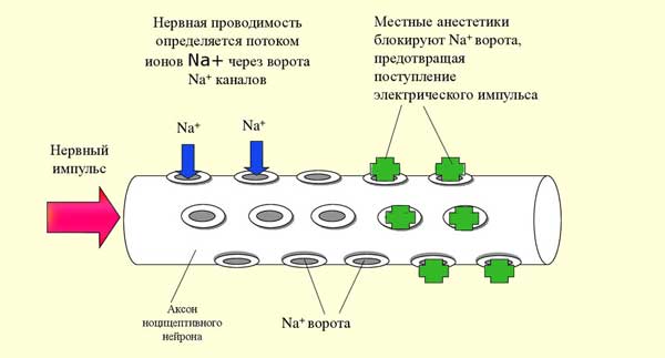 Механизм действия местной анестезии