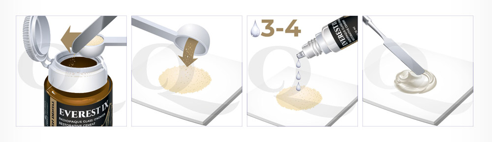 Everest IX ( Эверест IX) – высоконаполненный стеклоиономерный цемент (СИЦ) химического отверждения