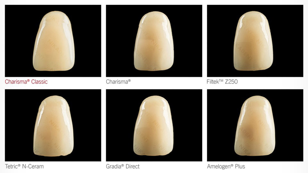 Харизма Классик - композитный материал для реставрации зубов