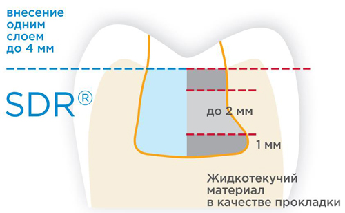 SDR Dentsply