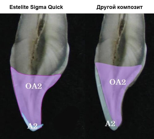 Estelite Sigma Quick выбор оттенка