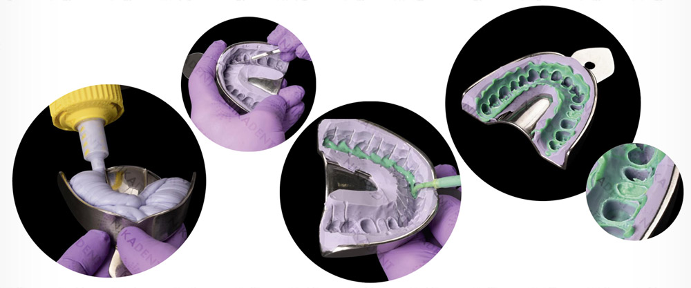 Вариотайм - А-силикон стоматологический для снятия оттисков