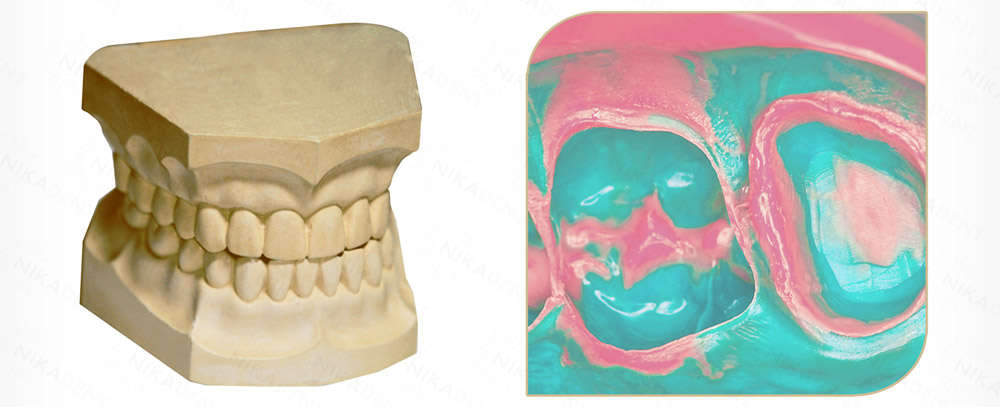 vonflex S Light, А-силикон стоматологический для корригирующих оттисков.