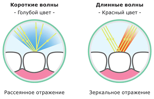 Отражение света как от естественного зуба