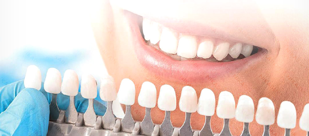 ДентЛайт - светоотверждаемый композит для лечения зубов.