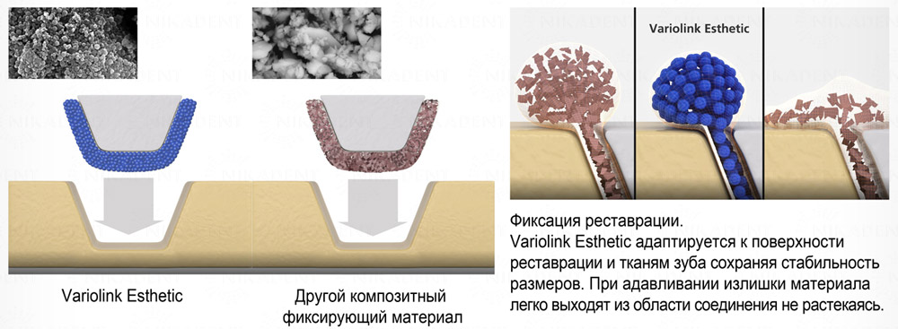 Variolink Esthetic - композитный цемент для фиксации виниров, вкладок, накладок, коронок