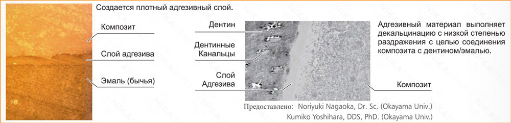 iGOS BOND - стоматологический адгезив 6 поколения