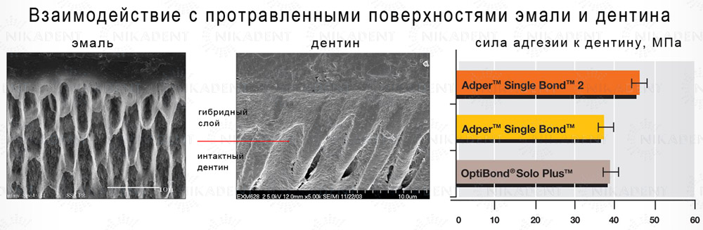 Adper Single Bond 2