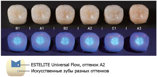 Estelite Universal Flow 