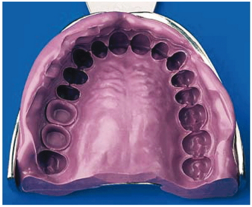 Silagum Medium Оттиск монофазный