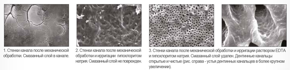 EDTA 18% - хелатный агент для кондиционирования стенок корневого канала.