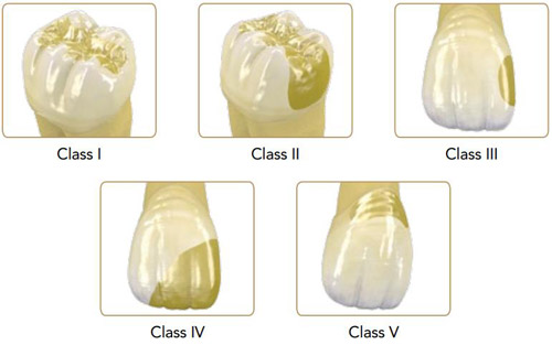 G-aenial Universal Flo – подходит для всех полостей 