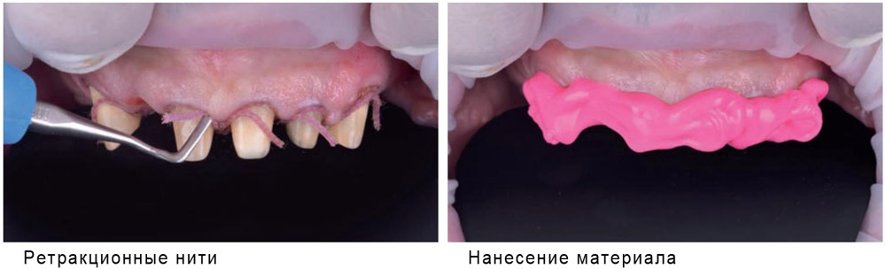 Hydrorise Hydrorise