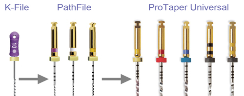 Pathfile Dentsply