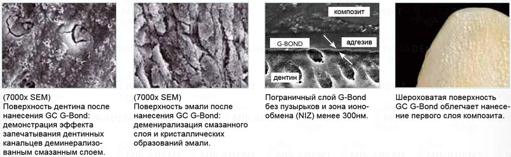 G-Bond адгезивная система VII поколения. Травление, прайминг и бондинг – одним материалом. Наносится в ОДИН СЛОЙ.