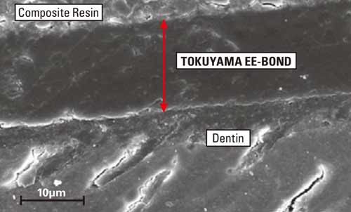 TOKUYAMA EE-BOND адгезия к дентину, создание гибридного слоя