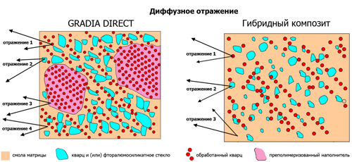GRADIA DIRECT ANTERIOR и POSTERIOR