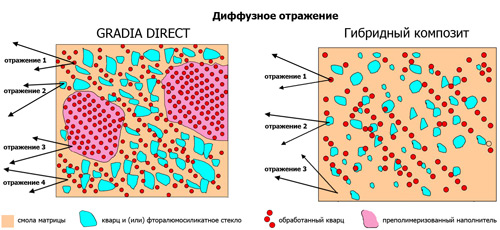 GRADIA DIRECT ANTERIOR и POSTERIOR