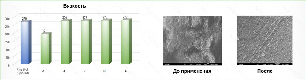 Протравливающий гель FineEtch 37% фосфорной кислоты 